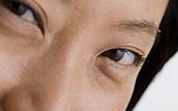Cách làm sạch bụi trong mắt